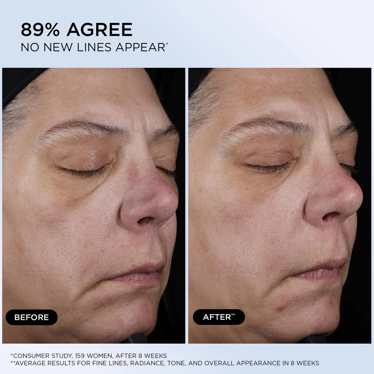 Génifique Ultimate Recovery Serum
