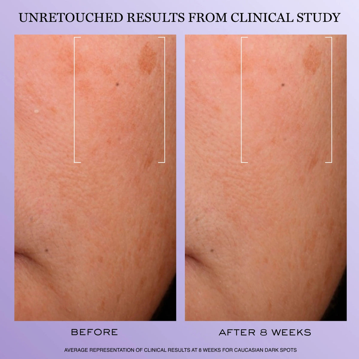 Rénergie H.C.F. Triple Serum