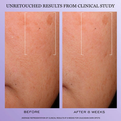 Rénergie H.C.F. Triple Serum