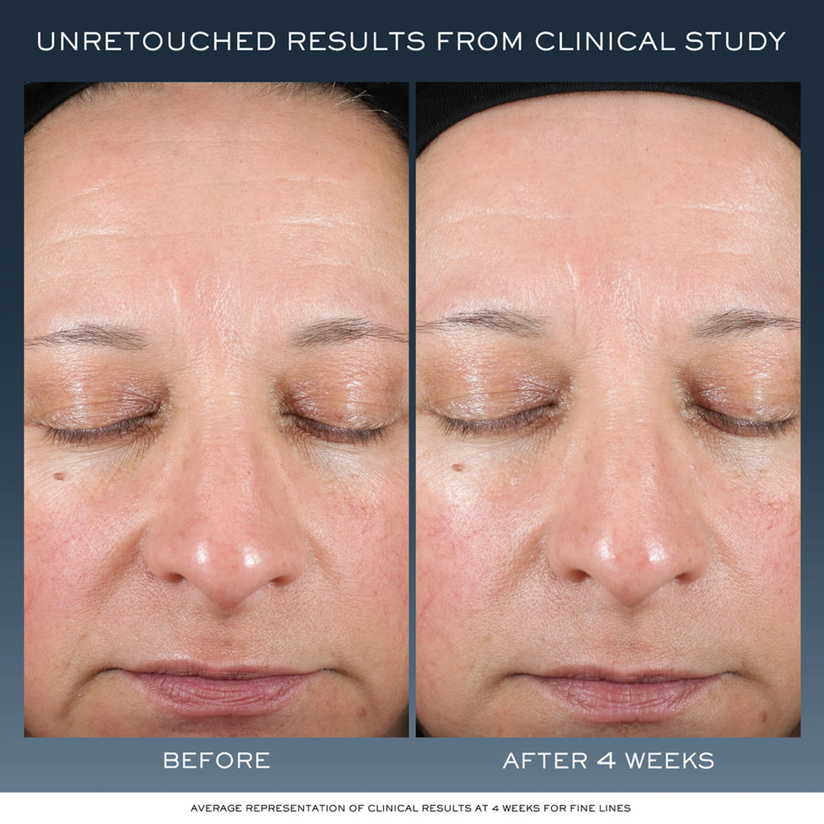 Advanced Génifique Night Cream