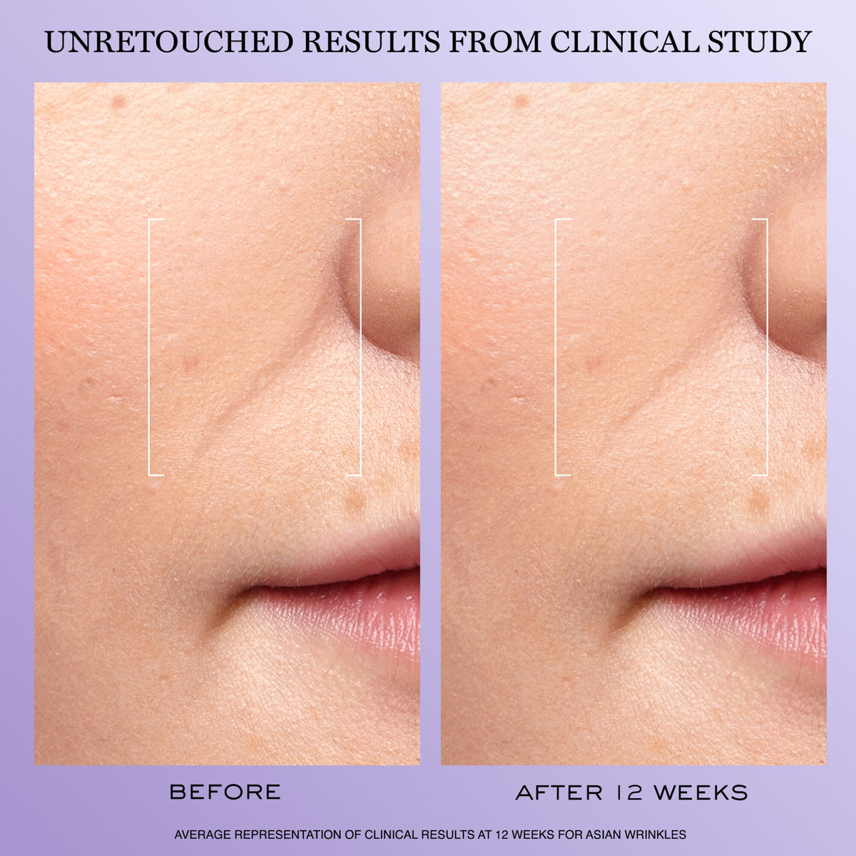 Rénergie H.C.F. Triple Serum