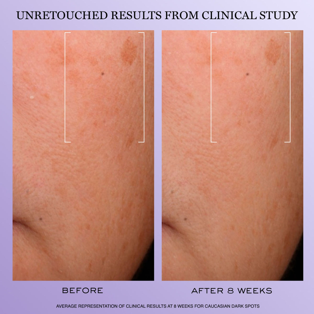 Rénergie H.C.F. Triple Serum